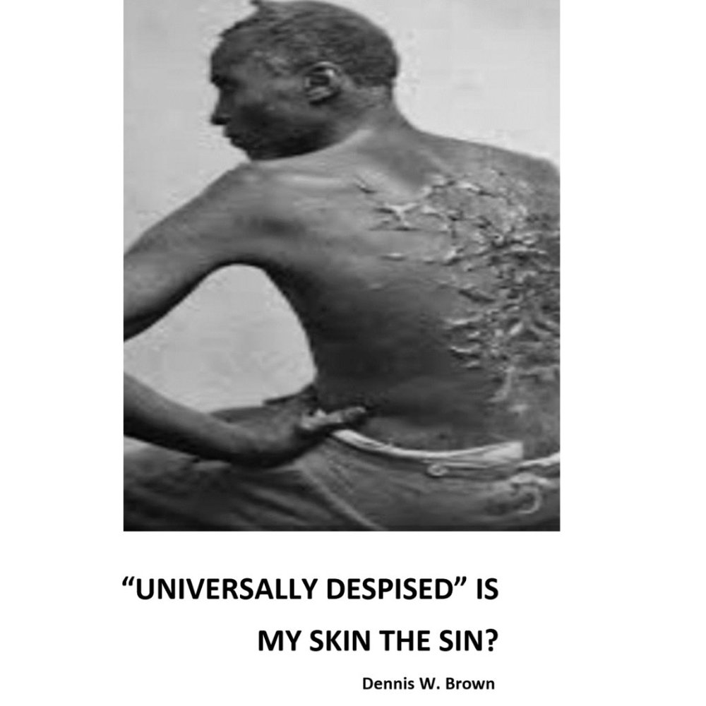 "Universally Despised" Is My Skin The Sin?
